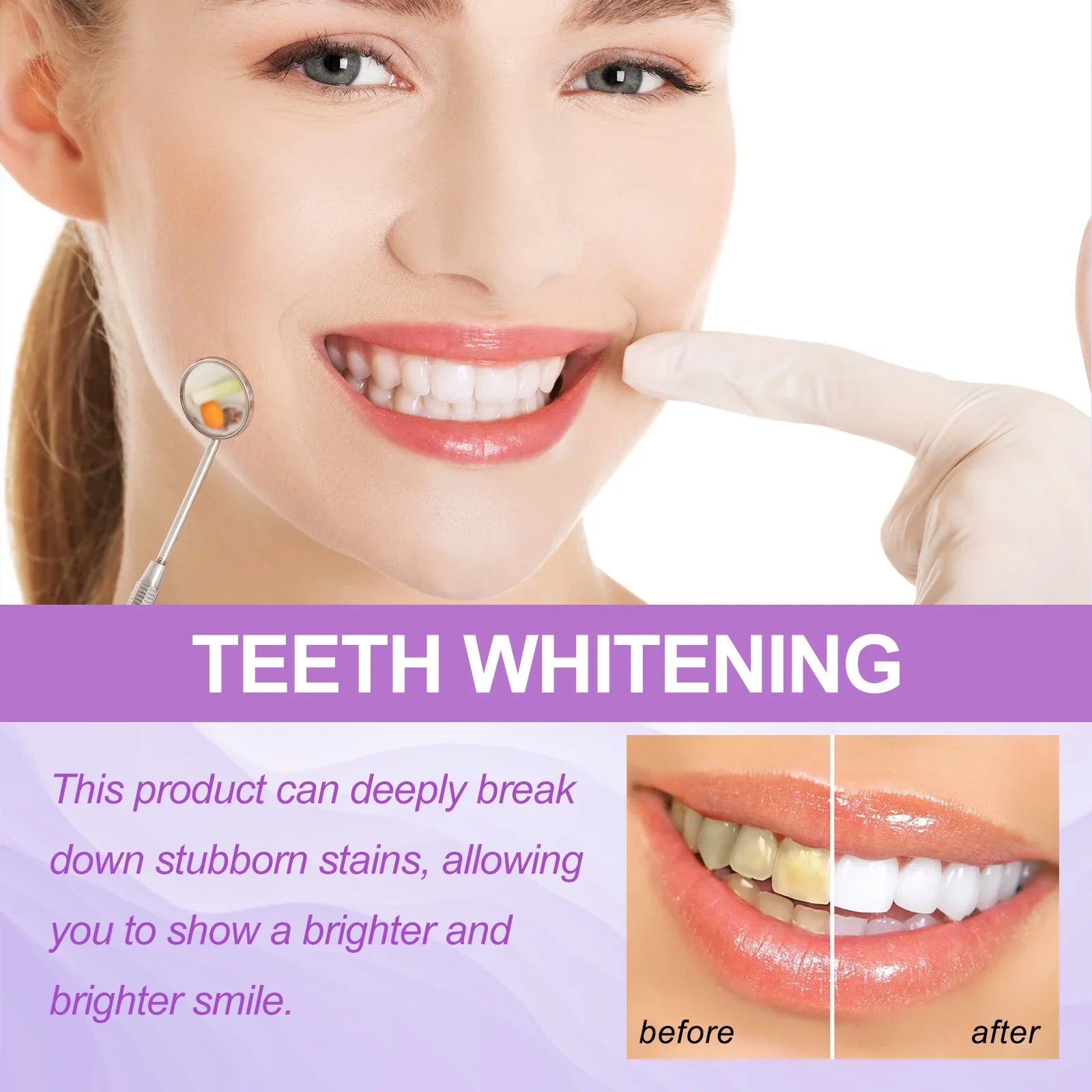 VividLuxe Teeth Whitening 14  Strips