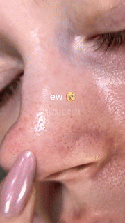 ClearPore Hydro Nose Strips